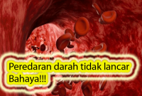 darah1 PEREDARAN DARAH TIDAK LANCAR, BAHAYA!!