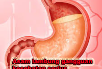 asam lambung gangguan kesehatan serius