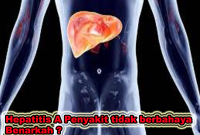hepatitis A penyakit tidak berbahaya