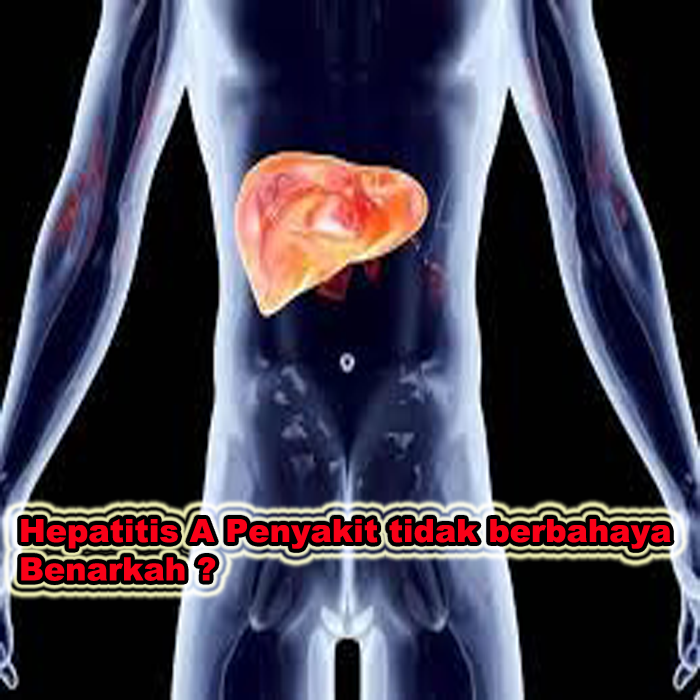 hepatitis A penyakit tidak berbahaya