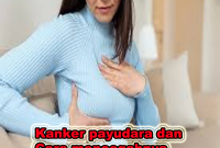 kanker-payudara1