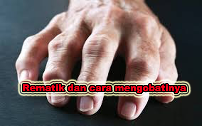rematik dan cara mengobatinya